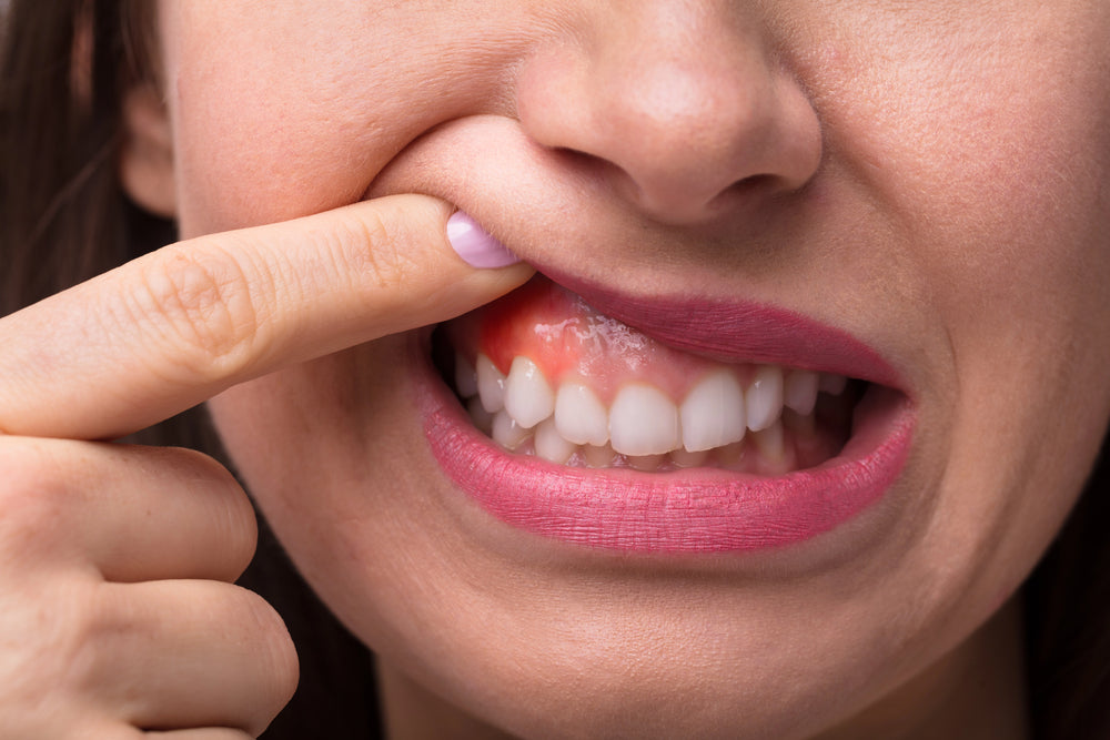 Woman with inflamed gums