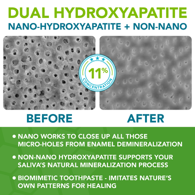 Dentist Formulated Fluoride Free Remineralizing Toothpaste with Nano Hydroxyapatite for Enamel Repair and Sensitive Teeth Wintermint Flavor